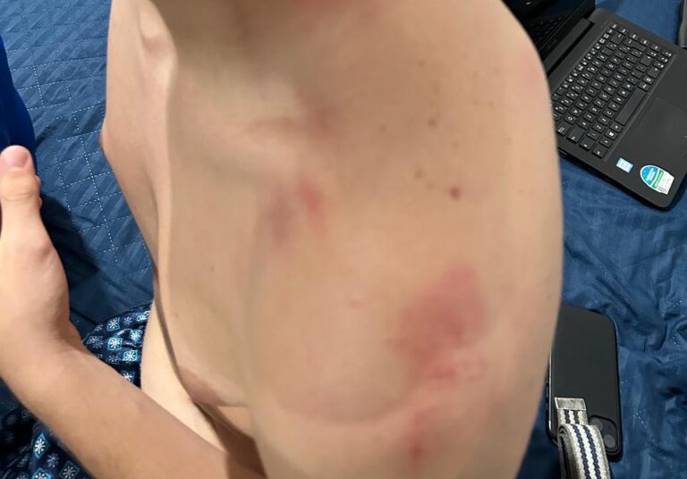 Adolescente é atacado por homem com máscara de palhaço em Itajaí