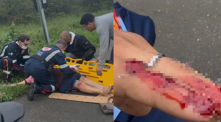 Mãe e filho ficam feridos após queda de scooter elétrica na Transbeto, em Penha